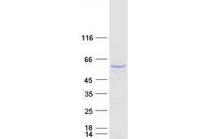 Western Blotting (WB) image for Tubulin, beta 2B (TUBB2B) protein (Myc-DYKDDDDK Tag) (ABIN2734574)