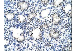 Image no. 1 for anti-Nuclear Receptor Subfamily 2, Group C, Member 1 (NR2C1) (C-Term) antibody (ABIN6736280) (NR2C1 抗体  (C-Term))