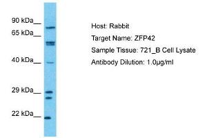 Host:  Rabbit  Target Name:  ZFP42  Sample Type:  721_B Whole cell lysates  Antibody Dilution:  1. (ZFP42 抗体  (N-Term))