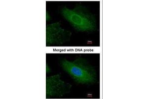 Immunofluorescence (IF) image for anti-Radixin (RDX) antibody (ABIN2856100)