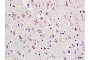 Formalin-fixed and paraffin embedded rat brain tissue labeled with Anti-E2F1 Polyclonal Antibody , Unconjugated at 1:200, followed by conjugation to the secondary antibody and DAB staining (E2F1 抗体  (AA 101-180))