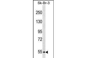 PCSK4 Antibody (N-term) (ABIN1539110 and ABIN2848552) western blot analysis in SK-BR-3 cell line lysates (35 μg/lane). (PCSK4 抗体  (N-Term))