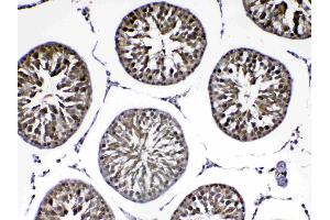 IHC analysis of PARK7 / DJ1 using anti-PARK7 / DJ1 antibody . (PARK7/DJ1 抗体  (AA 2-189))