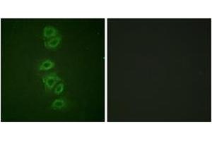 Immunofluorescence analysis of A549 cells, using PP2A-alpha (Phospho-Tyr307) Antibody. (PPP2CA 抗体  (pTyr307))
