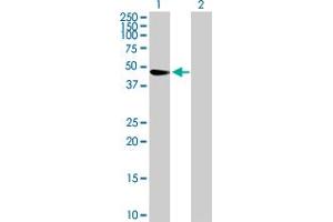 Western Blot analysis of TRIM47 expression in transfected 293T cell line by TRIM47 MaxPab polyclonal antibody. (TRIM47 抗体  (AA 1-400))