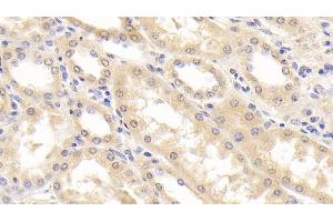 Detection of RBP4 in Human Kidney Tissue using Monoclonal Antibody to Retinol Binding Protein 4 (RBP4) (RBP4 抗体  (AA 18-201))