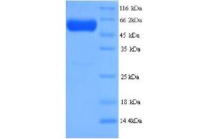 SDS-PAGE (SDS) image for Septin 7 (SEPT7) (AA 2-437) protein (His tag) (ABIN5714334) (Septin 7 Protein (SEPT7) (AA 2-437) (His tag))