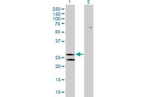 Western Blotting (WB) image for anti-ATP Synthase, H+ Transporting, Mitochondrial Fo Complex, Subunit B1 (ATP5F1) (AA 1-256) antibody (ABIN513620)