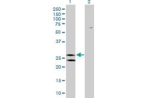 Western Blot analysis of ATP5F1 expression in transfected 293T cell line by ATP5F1 MaxPab polyclonal antibody. (ATP5F1 抗体  (AA 1-256))