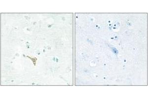 Immunohistochemistry analysis of paraffin-embedded human brain tissue, using RECK Antibody. (RECK 抗体  (AA 21-70))