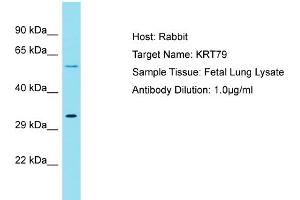 Host: Rabbit Target Name: KRT79 Sample Tissue: Human Fetal Lung Antibody Dilution: 1ug/ml (Cytokeratin 79 抗体  (C-Term))