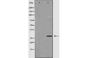 Western blot analysis of Cathepsin G expression in COLO cells,The lane on the left is treated with the antigen-specific peptide. (Cathepsin G 抗体  (Internal Region))