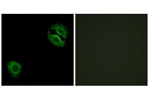 Immunofluorescence (IF) image for anti-Collagen, Type XIX, alpha 1 (COL19A1) (Internal Region) antibody (ABIN1850312) (COL19A1 抗体  (Internal Region))