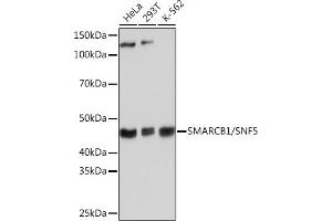 Western Blotting (WB) image for anti-SWI/SNF Related, Matrix Associated, Actin Dependent Regulator of Chromatin, Subfamily B, Member 1 (SMARCB1) antibody (ABIN7270657)