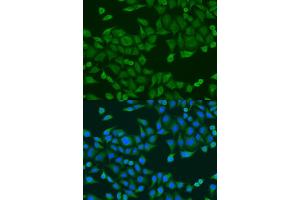 Immunofluorescence analysis of U2OS cells using RPS27A antibody (ABIN1874657) at dilution of 1:100. (RPS27A 抗体)