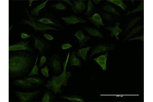 Immunofluorescence of monoclonal antibody to COL5A2 on HeLa cell. (COL5A2 抗体  (AA 41-124))