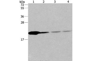 Western Blot analysis of Human fetal liver tissue and 293T cell, Human liver cancer tissue and hela cell using PPIB Polyclonal Antibody at dilution of 1:500 (PPIB 抗体)
