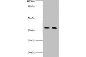 Western blot All lanes: Carbonic anhydrase 14 antibody at 5 μg/mL Lane 1: Mouse liver tissue Lane 2: Jurkat whole cell lysate Secondary Goat polyclonal to rabbit IgG at 1/10000 dilution Predicted band size: 38 kDa Observed band size: 38 kDa (CA14 抗体  (AA 16-290))