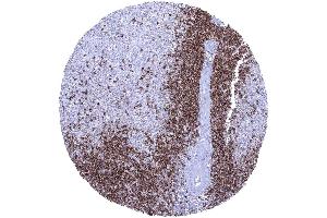 CD22 positive B lymphocytes predominate in the white pulp but are only sparse in the red pulp (Recombinant CD22 抗体  (AA 52-178))