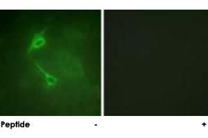 Immunofluorescence analysis of NIH/3T3 cells, using PRKCZ polyclonal antibody .