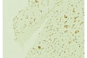 ABIN6276756 at 1/100 staining Mouse brain tissue by IHC-P. (ERCC5 抗体  (N-Term))
