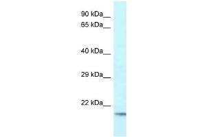 Western Blot showing UBE2V1 antibody used at a concentration of 1 ug/ml against Fetal Brain Lysate (UBE2V1 抗体  (C-Term))