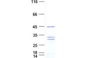 Western Blotting (WB) image for RAN Binding Protein 1 (RANBP1) protein (His tag) (ABIN2730451)