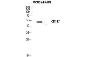 Western Blotting (WB) image for anti-Tumor Necrosis Factor Receptor Superfamily, Member 9 (TNFRSF9) (Internal Region) antibody (ABIN3183733) (CD137 抗体  (Internal Region))