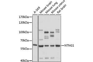 Western blot analysis of extracts of various cell lines, using NTNG1 antibody (ABIN7268853) at 1:1000 dilution. (Netrin G1 抗体  (AA 29-300))