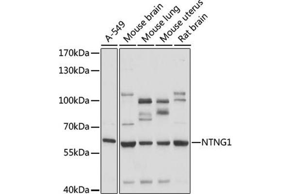 Netrin G1 抗体  (AA 29-300)