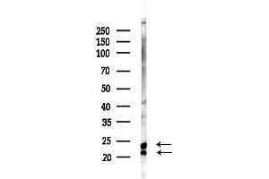 Western blot analysis of lysates from PC12 cells(LPS, 4h treatment), using Transgelin 2 Antibody at 1/1000 dilution.