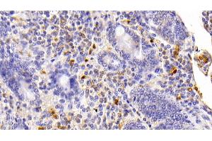 Detection of S100B in Bovine Small intestine Tissue using Polyclonal Antibody to S100 Calcium Binding Protein B (S100B) (S100B 抗体  (AA 1-92))