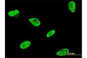 Immunofluorescence of monoclonal antibody to TP53RK on HeLa cell. (TP53RK 抗体  (AA 154-253))