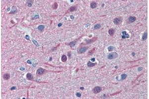 Human Brain, Cortex: Formalin-Fixed, Paraffin-Embedded (FFPE) (TUBB2A 抗体  (AA 1-446))