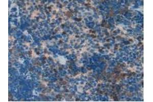 Detection of S100A11 in Rat Spleen Tissue using Polyclonal Antibody to S100 Calcium Binding Protein A11 (S100A11) (S100A11 抗体  (AA 9-98))