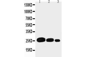Anti-Adiponectin antibody, Western blottingRecombinant Protein Detection Source: E. (ADIPOQ 抗体  (C-Term))