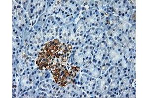 Immunohistochemical staining of paraffin-embedded Kidney tissue using anti-PLEKmouse monoclonal antibody. (Pleckstrin 抗体)
