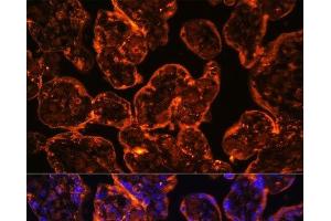 Immunofluorescence analysis of Human placenta using ENTPD1/CD39 Polyclonal Antibody at dilution of 1:100 (40x lens). (CD39 抗体)