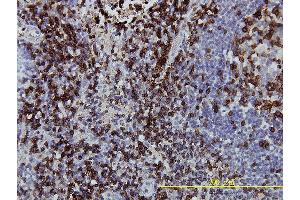 Immunoperoxidase of monoclonal antibody to CD3Z on formalin-fixed paraffin-embedded human lymph node tissue. (CD247 抗体  (AA 1-164))