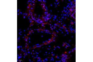 Immunofluorescence (Paraffin-embedded Sections) (IF (p)) image for anti-Prothymosin, alpha (PTMA) antibody (ABIN7075306)