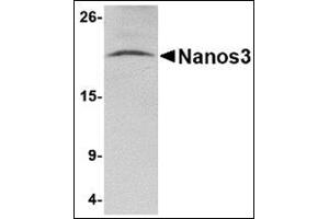 Western blot analysis of Nanos3 in human brain tissue lysate with this product at 2 μg/ml. (NANOS3 抗体  (C-Term))