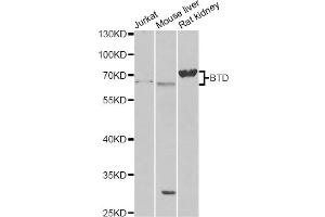 Western blot analysis of extracts of various cell lines, using BTD antibody (ABIN6290108) at 1:1000 dilution. (BTD 抗体)