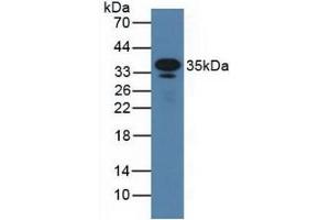 Western Blotting (WB) image for anti-Fc Fragment of IgE, Low Affinity II, Receptor For (CD23) (FCER2) (AA 150-330) antibody (ABIN7433822)