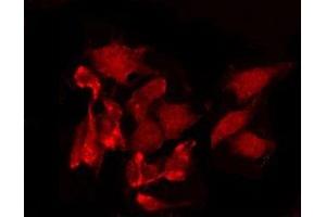 Immunofluorescence (fixed cells) (IF/ICC) image for anti-Cyclin A1 (CCNA1) antibody (ABIN6261140)