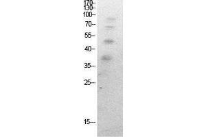 Western Blot (WB) analysis of HeLa cells using Acetyl-Ub (K27) Polyclonal Antibody. (Ubiquitin 抗体  (acLys27))