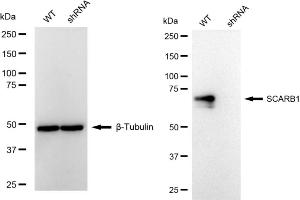 Western blotting analysis using SCARB1 antibody (ABIN7800276). (Recombinant SCARB1 抗体)