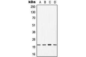 Western blot analysis of CDC42 expression in Jurkat (A), HT29 (B), mouse brain (C), rat liver (D) whole cell lysates. (CDC42 抗体  (Center))