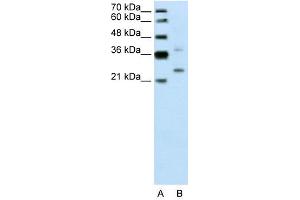 WB Suggested Anti-DCUN1D1  Antibody Titration: 0. (DCUN1D1 抗体  (N-Term))