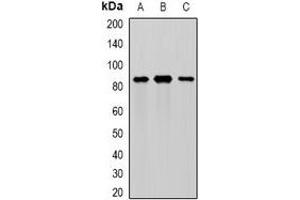 Western blot analysis of MEP1A expression in mouse intestine (A), mouse pancreas (B), rat kidney (C) whole cell lysates. (MEP1A 抗体)