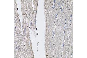 Immunohistochemistry of paraffin-embedded mouse heart using SLC2A3 antibody (ABIN5974794) (40x lens). (SLC2A3 抗体)